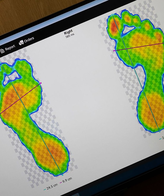 Gait Analysis Service London - Gilbert & Lisson